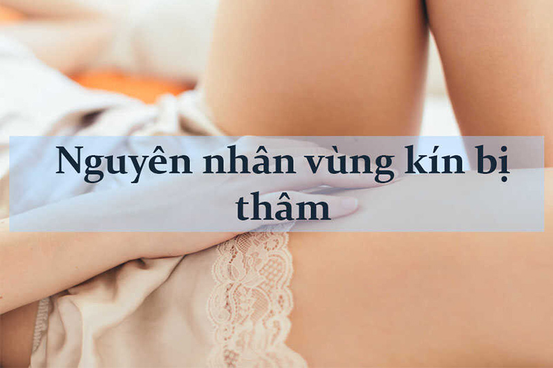 nguyên-nhân-khiến-vùng-kín-bị-thâm